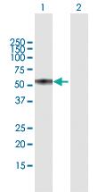 Anti-TNFRSF1A Mouse Polyclonal Antibody