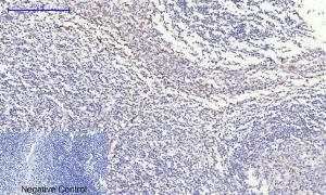 Immunohistochemical analysis of paraffin-embedded human Tonsil tissue using Anti-IkappaB-alpha Antibody at 1:200 (4°C overnight). Negative control was secondary antibody only.