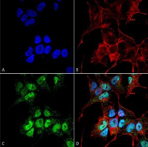 Immunocytochemistry/Immunofluorescence analysis of human neuroblastoma cell line (SK-N-BE, fixed in 4% formaldehyde for 15 min at room temperature, using Anti-GABARAPL1 Antibody (A304907), at 1:100 for 60 minutes at room temperature