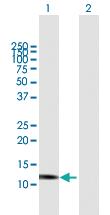 Anti-GNLY Mouse Polyclonal Antibody