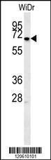 Anti-MEIS2 Rabbit Polyclonal Antibody (AP (Alkaline Phosphatase))