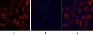 Immunofluorescence analysis of mouse kidney tissue using Anti-IkappaB-alpha Antibody (red) at 1:200 (4°C overnight). Cy3 labelled secondary antibody was used at 1:300 (RT 50min). Panel A: Target. Panel B: DAPI. Panel C: Merge.