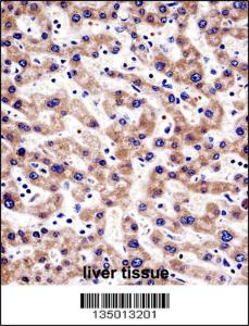 Anti-HTATIP2 Rabbit Polyclonal Antibody