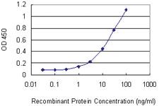 Anti-GNLY Mouse Monoclonal Antibody [clone: 2A6]