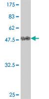 Anti-KLHDC3 Mouse Polyclonal Antibody