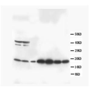 Anti-S100 beta Rabbit Polyclonal Antibody