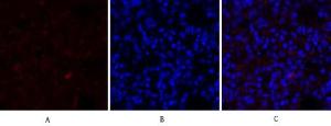 Immunofluorescence analysis of rat lung tissue using Anti-IkappaB-alpha Antibody (red) at 1:200 (4°C overnight). Cy3 labelled secondary antibody was used at 1:300 (RT 50min). Panel A: Target. Panel B: DAPI. Panel C: Merge.