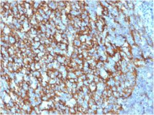 Immunohistochemical analysis of formalin-fixed, paraffin-embedded human tonsil using Anti-CD21 Antibody [CR2/1952]