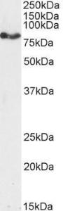 Anti-CPT1A Antibody (A82914) (2 µg/ml) staining of MCF7 cell lysate (35 µg protein in RIPA buffer). Detected by chemiluminescence