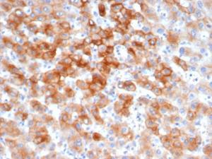 Immunohistochemical analysis of formalin-fixed, paraffin-embedded human colon tissue using Anti-Cytokeratin 8 Antibody [KRT8/6472R]