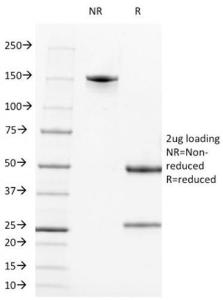 SDS-PAGE analysis of Anti-CD21 Antibody [CR2/1952] under non-reduced and reduced conditions; showing intact IgG and intact heavy and light chains, respectively. SDS-PAGE analysis confirms the integrity and purity of the antibody