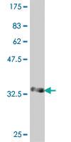 Anti-ST6GALNAC1 Mouse Polyclonal Antibody