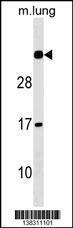 Anti-NAA60 Rabbit Polyclonal Antibody (APC (Allophycocyanin))