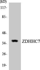 Western blot analysis of the lysates from HUVEC cells using Anti-ZDHHC7 Antibody