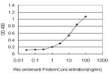 Anti-RNF122 Mouse Monoclonal Antibody [clone: 5E5]