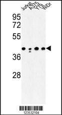 Anti-CANT1 Rabbit Polyclonal Antibody (AP (Alkaline Phosphatase))