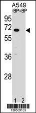 Anti-ASB3 Rabbit Polyclonal Antibody (AP (Alkaline Phosphatase))