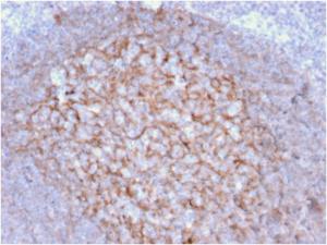 Immunohistochemical analysis of formalin-fixed, paraffin-embedded human tonsil using Anti-CD21 Antibody [CR2/1953]