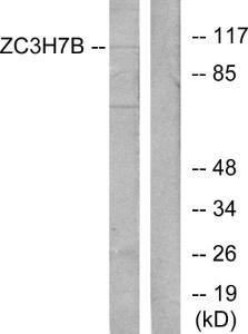 Western blot analysis of lysates from 293 cells using Anti-ZC3H7B Antibody. The right hand lane represents a negative control, where the antibody is blocked by the immunising peptide