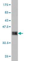 Anti-KMT2B Mouse Monoclonal Antibody [clone: 1F6]