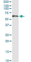 Anti-TBCE Polyclonal Antibody Pair