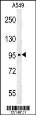 Anti-C15orf39 Rabbit Polyclonal Antibody (HRP (Horseradish Peroxidase))