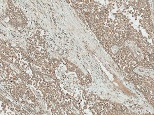 Immunohistochemistry analysis of human liver, fixed in formalin and paraffin-embedded. The Primary Antibody used was Anti-IGF1 Antibody (A304908) at 1:50 for 30 minutes at room temperature. Counterstain: Hematoxylin. Magnification: 10X. HRP-DAB Detection.