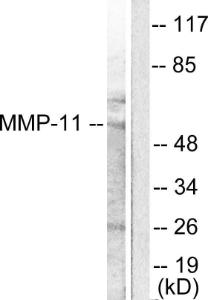 Western blot analysis of lysates from A549 cells using Anti-MMP-11 Antibody. The right hand lane represents a negative control, where the antibody is blocked by the immunising peptide