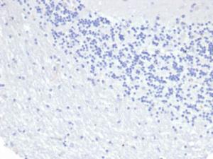 Negative Tissue Control: Immunohistochemical analysis of formalin-fixed, paraffin-embedded human brain using Anti-Cytokeratin 8 Antibody [KRT8/6472R] at 2 µg/ml in PBS for 30 minutes at room temperature