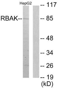 Western blot analysis of lysates from HepG2 cells using Anti-RBAK Antibody The right hand lane represents a negative control, where the antibody is blocked by the immunising peptide