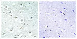 Immunohistochemical analysis of paraffin-embedded human brain using Anti-ZC3H7B Antibody 1:100 (4°C overnight). The right hand panel represents a negative control, where the antibody was pre-incubated with the immunising peptide