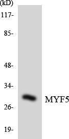 Western blot analysis of the lysates from K562 cells using Anti-MYF5 Antibody