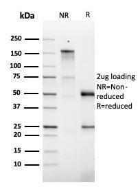 Anti-GM-CSF Mouse Monoclonal Antibody [clone: CSF2/3403]