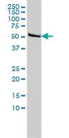 Anti-DLD Mouse Monoclonal Antibody [clone: 3C1]