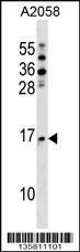 Anti-NAA20 Rabbit Polyclonal Antibody (Biotin)