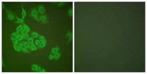 Immunofluorescence analysis of A549 cells using Anti-MMP-11 Antibody. The right hand panel represents a negative control, where the antibody was pre-incubated with the immunising peptide