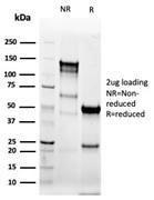 SDS-PAGE analysis of Anti-Cytokeratin 8 Antibody [KRT8/6472R] under non-reduced and reduced conditions; showing intact IgG and intact heavy and light chains, respectively. SDS-PAGE analysis confirms the integrity and purity of the antibody