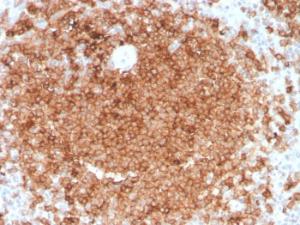 Anti-GM-CSF Mouse Monoclonal Antibody [clone: CSF2/3403]