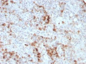 Anti-GM-CSF Mouse Monoclonal Antibody [clone: CSF2/3403]