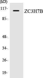 Western blot analysis of the lysates from HUVEC cells using Anti-ZC3H7B Antibody