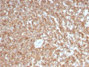 Anti-GM-CSF Mouse Monoclonal Antibody [clone: CSF2/3403]