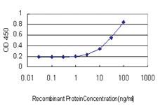 Anti-DLD Mouse Monoclonal Antibody [clone: 3C1]