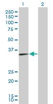 Anti-PRKY Rabbit Polyclonal Antibody