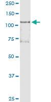 Anti-HDAC4 Polyclonal Antibody Pair