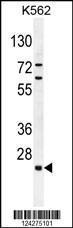 Anti-C15orf41 Rabbit Polyclonal Antibody (HRP (Horseradish Peroxidase))