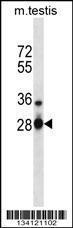 Anti-YBX3 Rabbit Polyclonal Antibody (APC (Allophycocyanin))