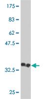 Anti-ASB13 Mouse Monoclonal Antibody [clone: 2A11]