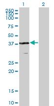 Anti-VPS26A Mouse Monoclonal Antibody [clone: 1C4]