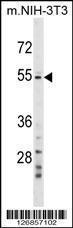 Anti-GPT2 Rabbit Polyclonal Antibody (AP (Alkaline Phosphatase))