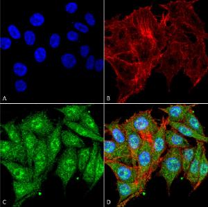 Immunocytochemistry/Immunofluorescence analysis of human colon carcinoma cell line (RKO), fixed in 4% formaldehyde for 15 min at room temperature, using Anti-IGF1 Antibody (A304908), at 1:100 for 60 minutes at room temperatur